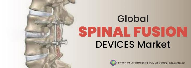 Top Players - Spinal Fusion Devices Industry