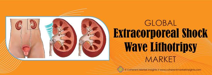 Major Players - Extracorporeal Shock Wave Lithotripsy Industry 