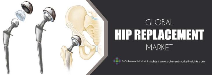 Major Players - Hip Replacement Industry