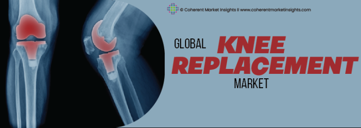 Leading Companies - Knee Replacement Industry