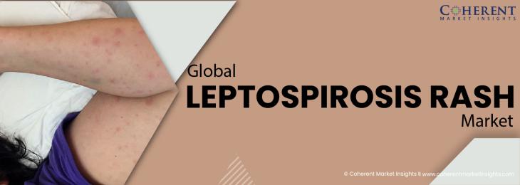 Major Players - Leptospirosis Industry