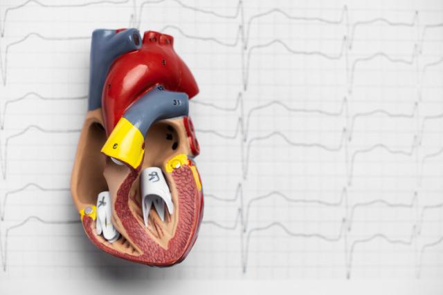 Key Factors Driving Growth in the Myocardial Infarction Market