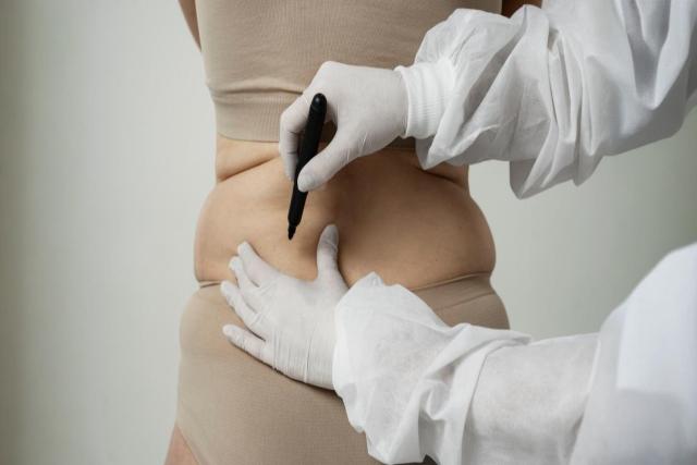 The Science Behind Cellulite: Causes and Treatment Mechanisms